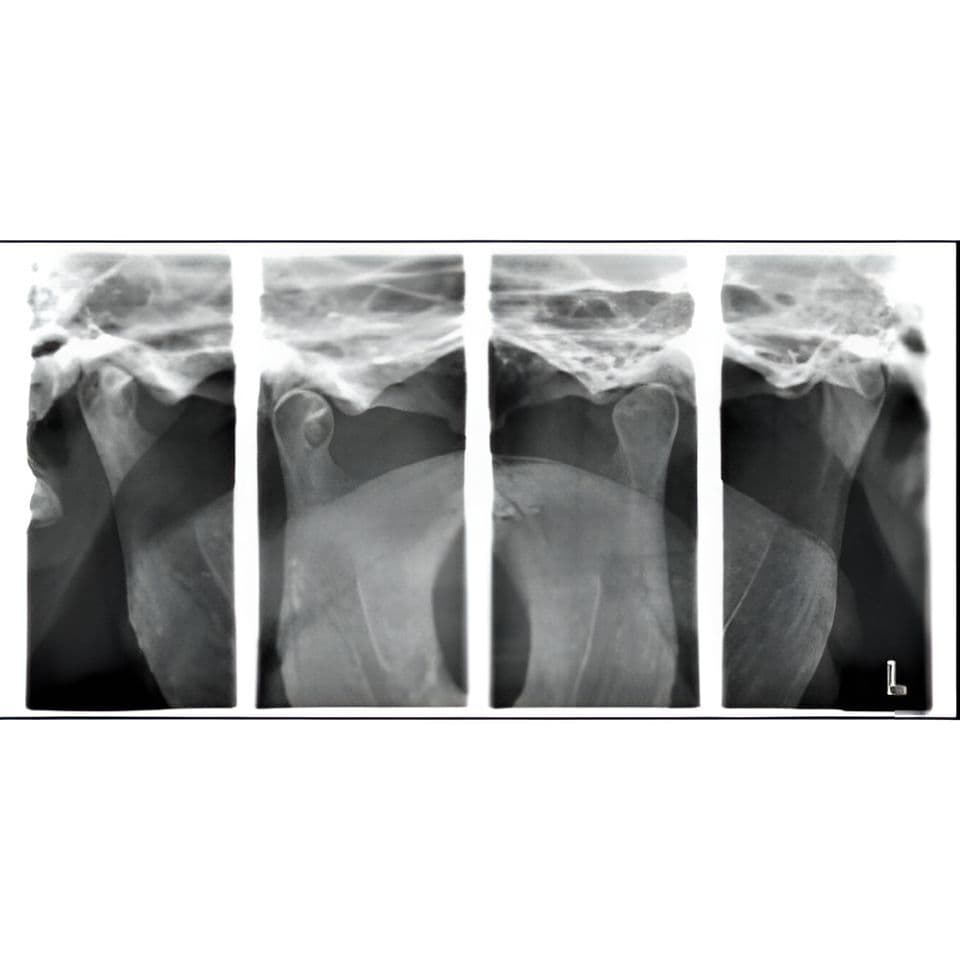 Planmeca ProMax Pan Dental X-Ray System thumbnail 9