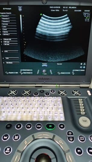 GE Voluson i Portable OB/GYN Ultrasound System thumbnail 8