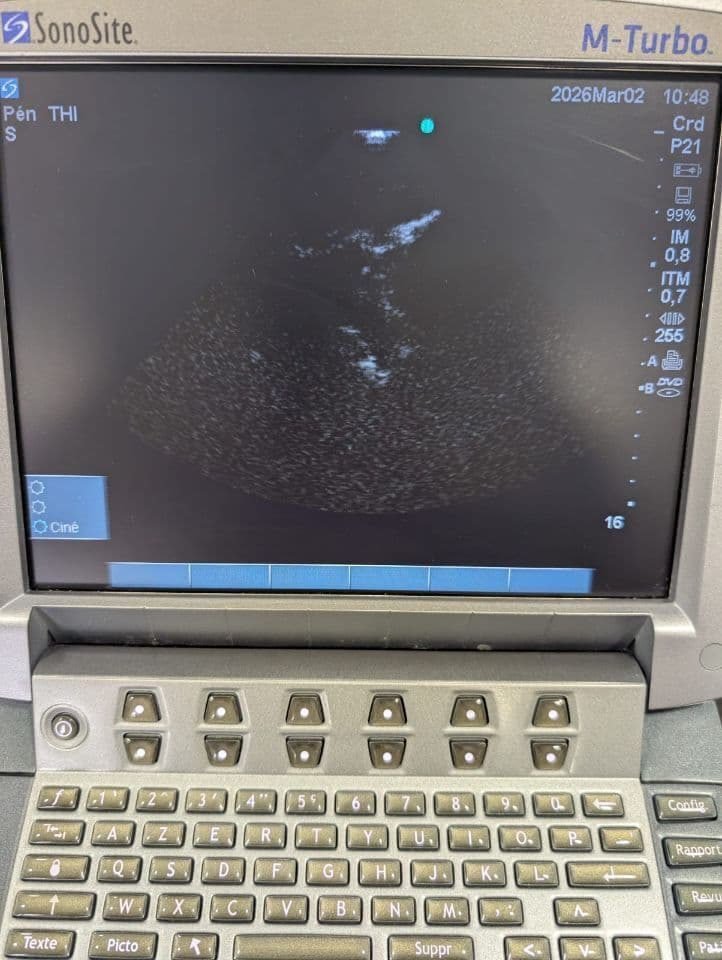 SonoSite P21x Cardiac Ultrasound Transducer thumbnail 6
