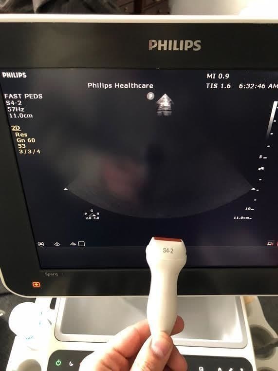 Philips S4-2 Phased Array Ultrasound Transducer thumbnail 2