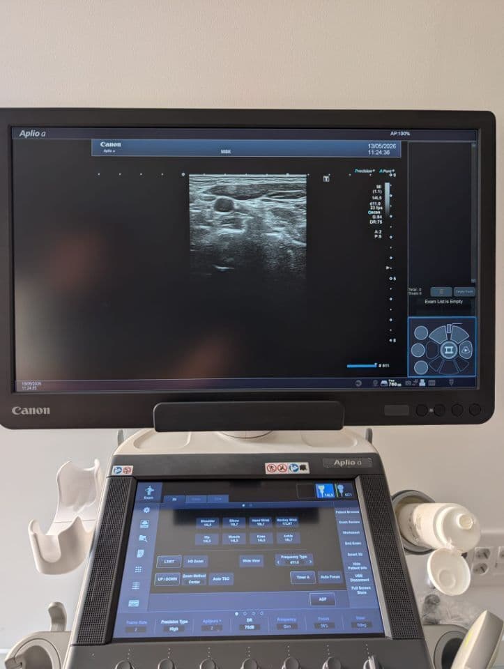 Toshiba Aplio A Diagnostic Ultrasound System thumbnail 7