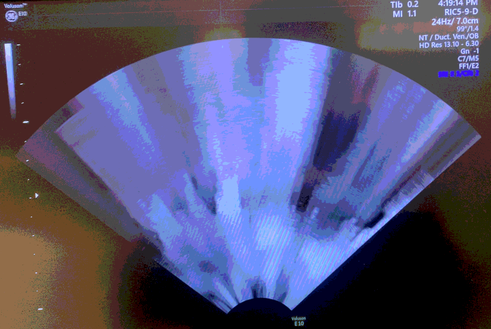 GE Voluson E8 Voluson E10 EC320 ultrasound machine repair RFM423 beamformer board) Artifact Imaging or no echo (KTZ304074 / 5729200 / KTZ304142) thumbnail 7