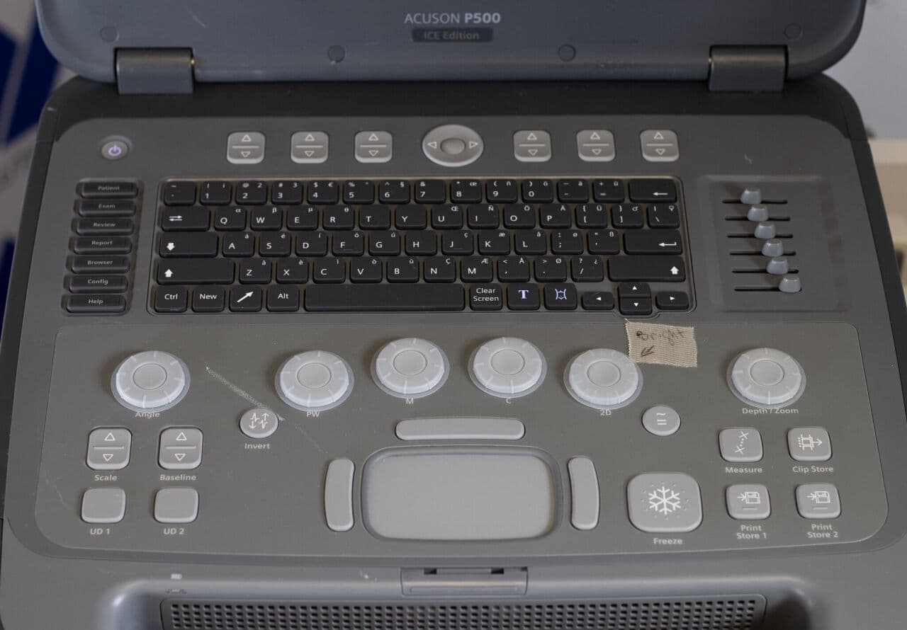 Siemens Acuson P500 Frosk Portable Ultrasound System thumbnail 13
