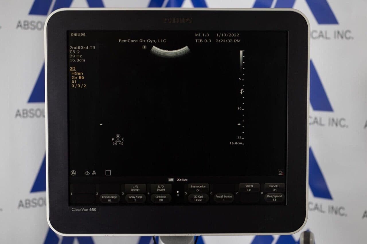Philips ClearVue 650 OB/GYN Ultrasound System thumbnail 4