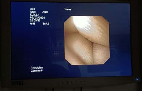 Olympus GIF-160 Video Gastroscope thumbnail 9