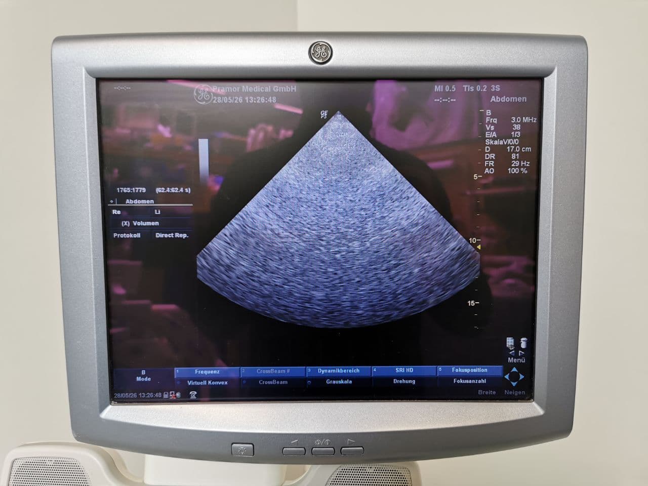 GE Healthcare 3s — Cardiac Ultrasound Probe thumbnail 7