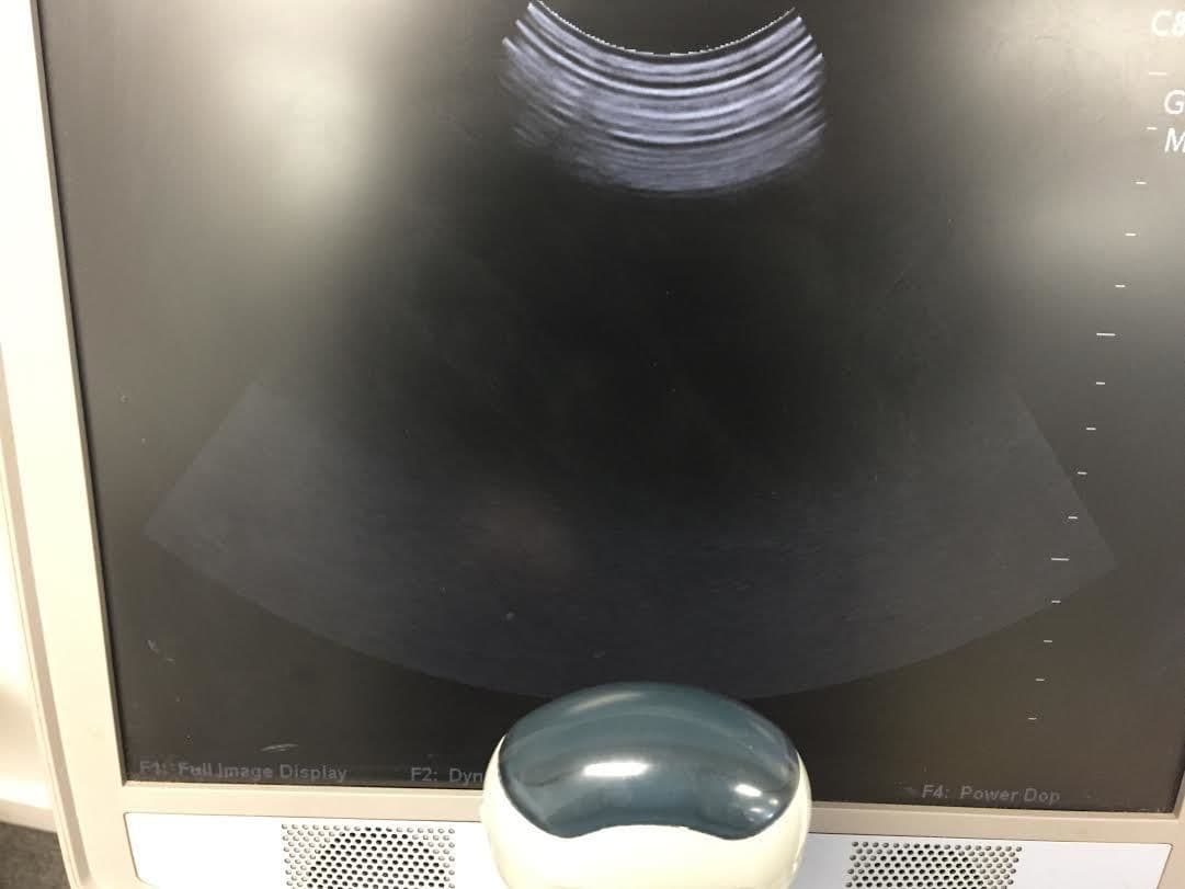 Zonare Z.One Ultrasound System thumbnail 3