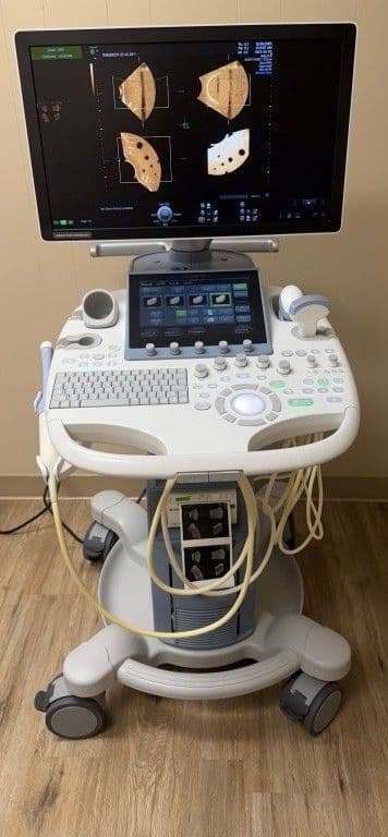 GE S8t OB/GYN Ultrasound System with 3D/4D Capabilities thumbnail 2