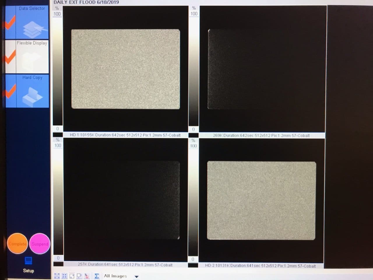 Siemens E-CAM / Symbia E SPECT Nuclear Gamma Camera thumbnail 4