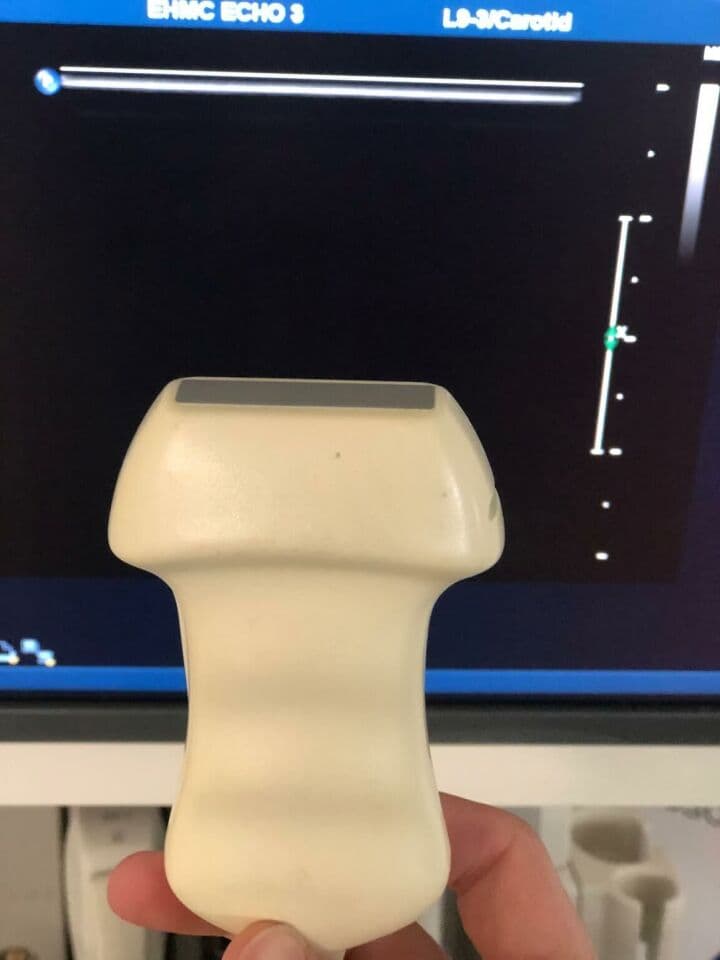 Philips IE33 Cardiovascular Ultrasound System thumbnail 5