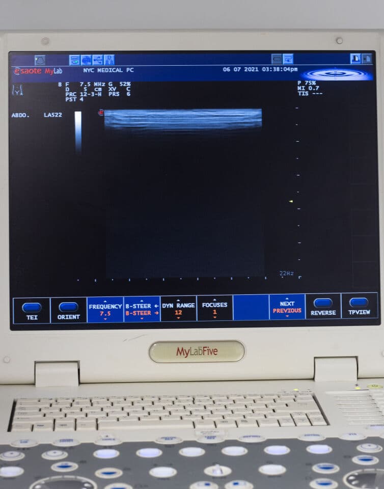 Esaote Biosound MyLab Five Portable Ultrasound System thumbnail 5