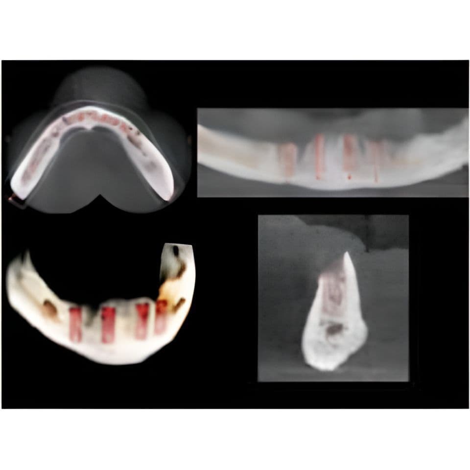 Carestream CS9000 Pan/CBCT 3D Dental X-Ray System thumbnail 7