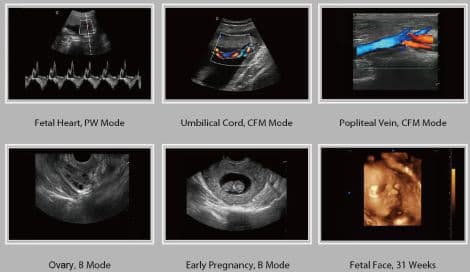 General Imaging Ultrasound System — Chison i3 thumbnail 4
