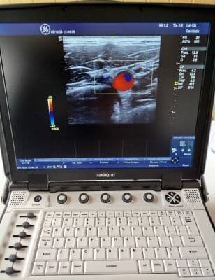 GE Logiq E Portable Ultrasound System thumbnail 7