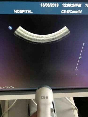 Philips C8-5 Convex Ultrasound Transducer Probe thumbnail 2