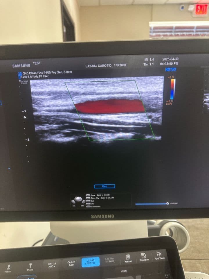 Samsung RS80A Diagnostic Ultrasound System thumbnail 8