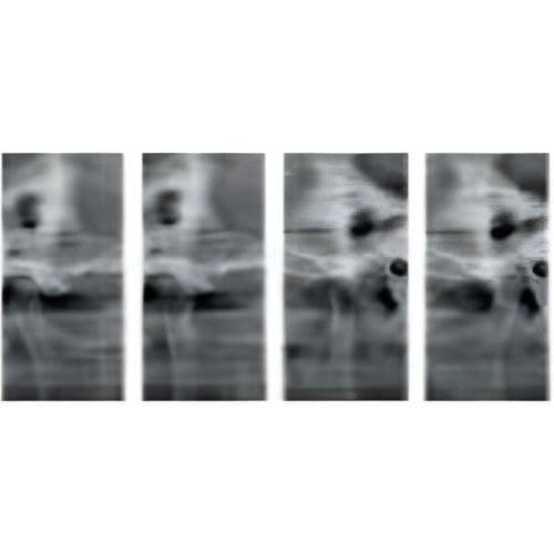Sirona Orthophos XG Pan Panoramic Dental X-Ray System thumbnail 5