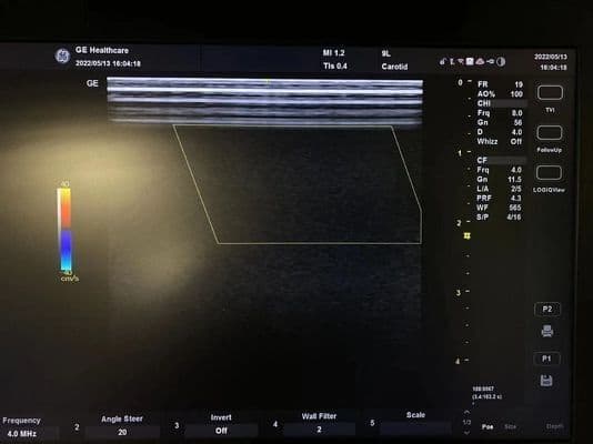 GE 9L-RS Linear Ultrasound Transducer thumbnail 4