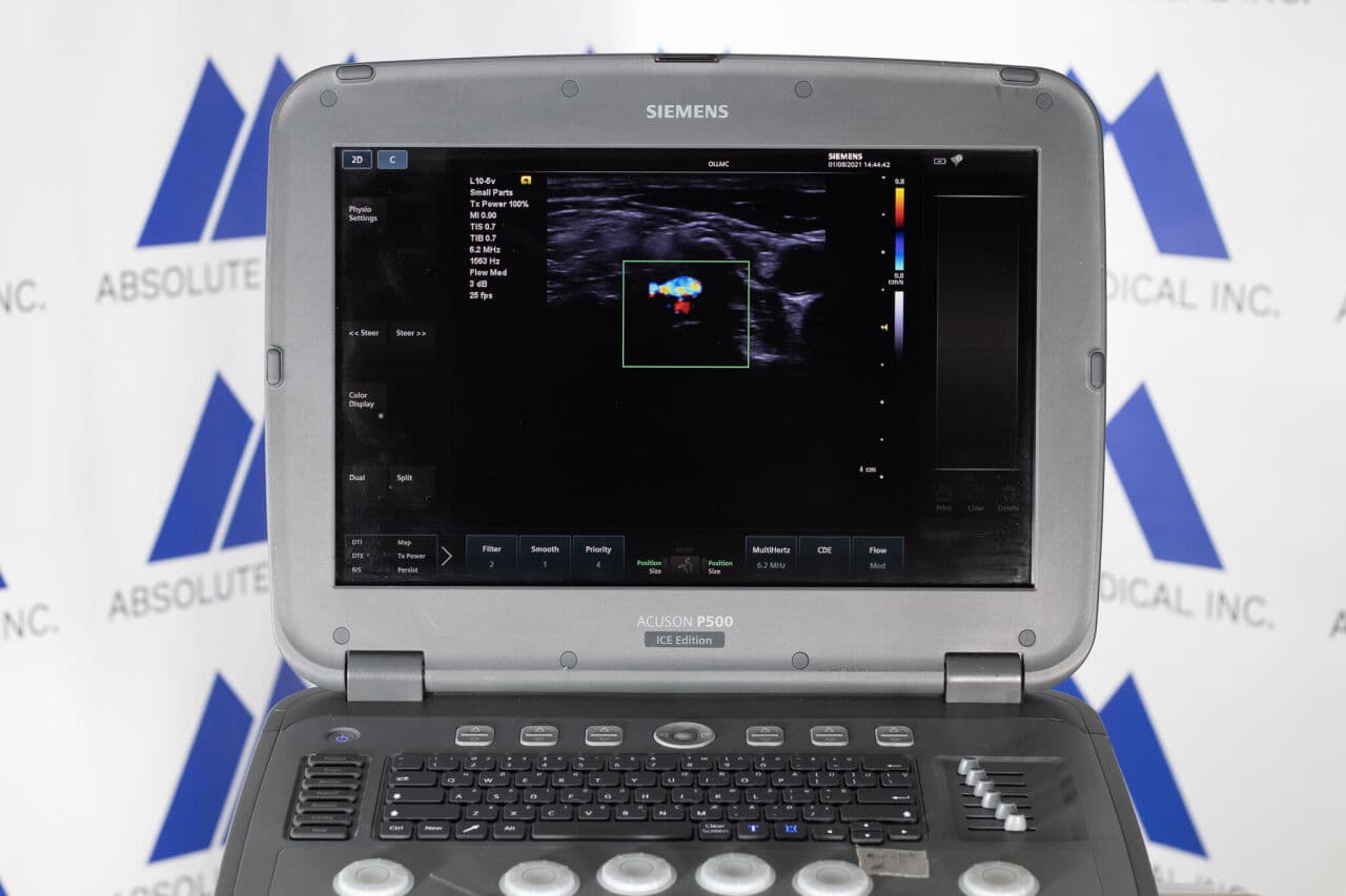 Siemens Acuson P500 Frosk Portable Ultrasound System thumbnail 5