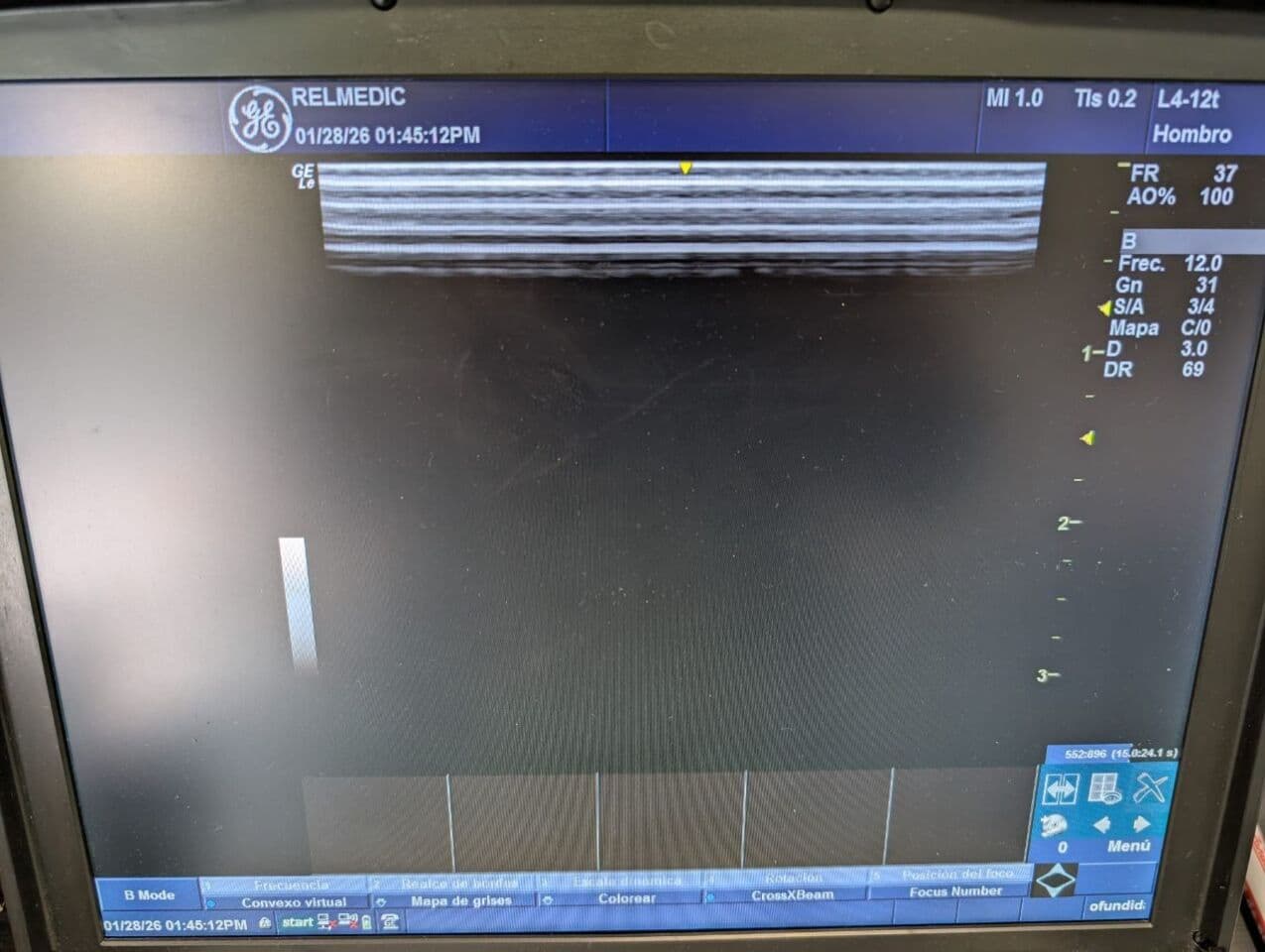 GE L4-12T-RS Linear Ultrasound Transducer thumbnail 7