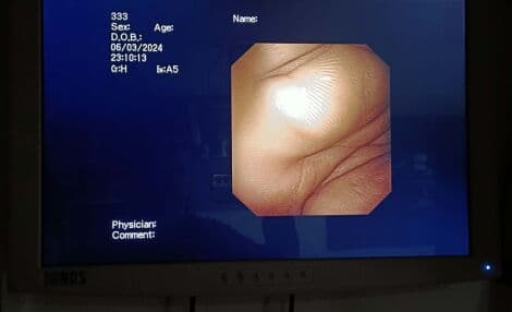 Olympus GIF-160 Video Gastroscope thumbnail 10