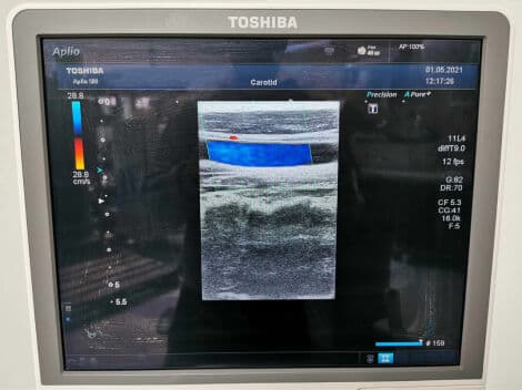 Linear Ultrasound Transducer — Toshiba PLT-704SBT thumbnail 7