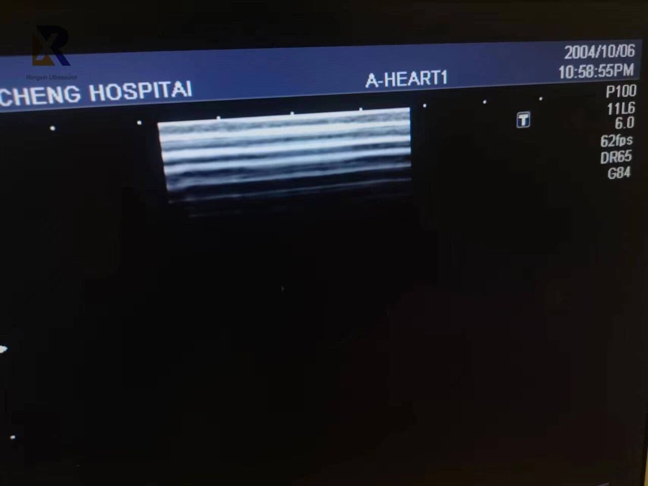 Toshiba PLM-703AT Linear Array Ultrasound Transducer thumbnail 4