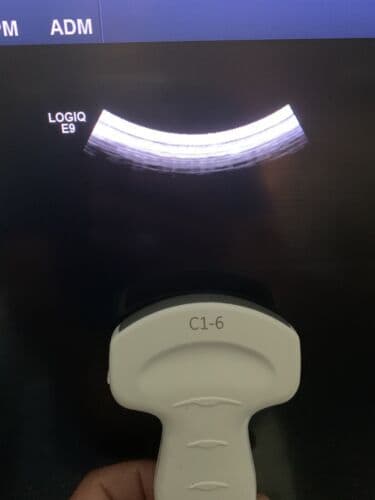 GE C1-6-D Convex Ultrasound Transducer Probe thumbnail 6