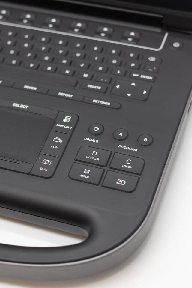 Sonosite Edge II Portable Ultrasound System thumbnail 4