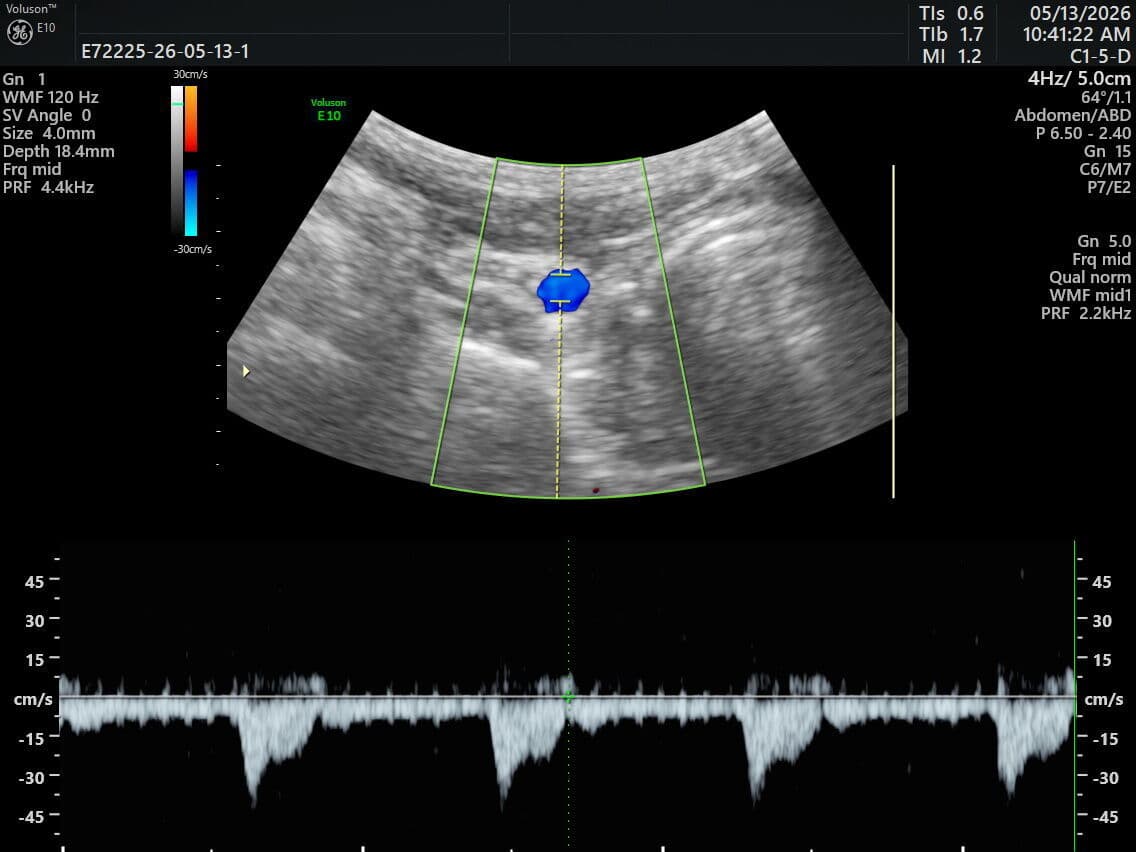 GE Healthcare C1-5-D Curved Array Ultrasound Transducer thumbnail 5