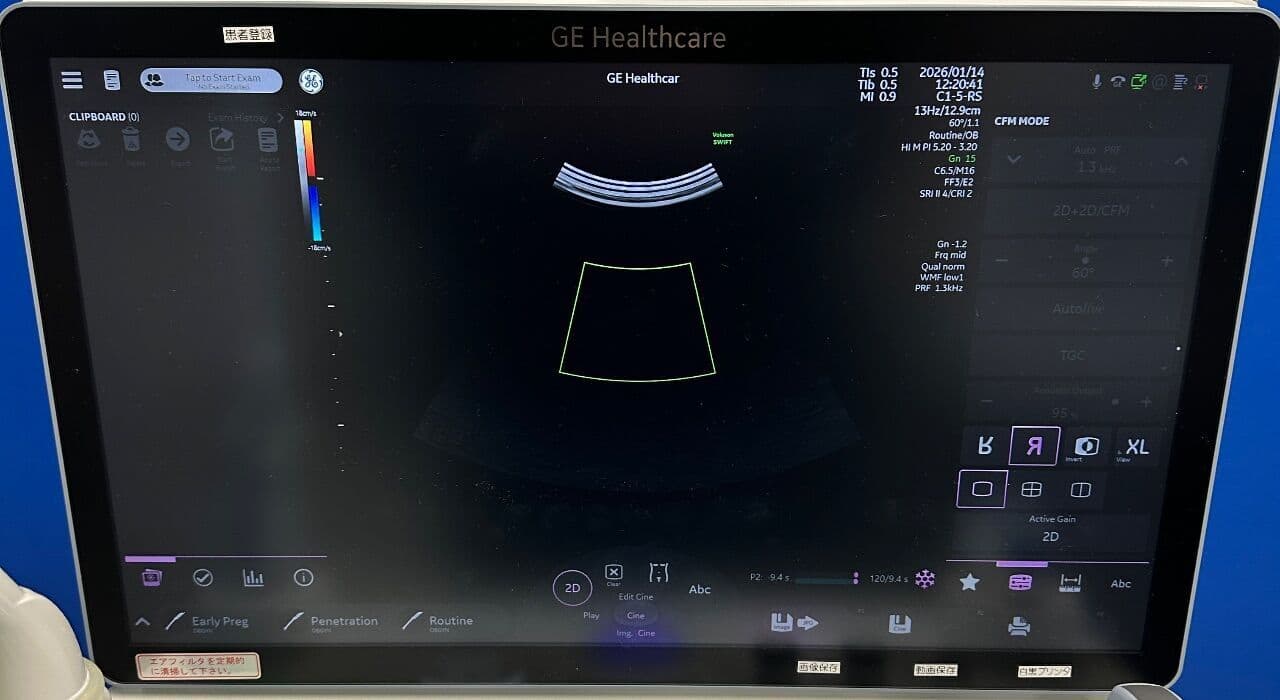 OB/GYN Ultrasound Imaging — GE Voluson Swift BT23 thumbnail 2