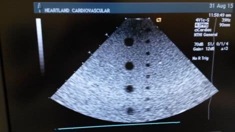 Acuson 4V1c Vector Array Ultrasound Transducer for Cardiac Imaging thumbnail 3