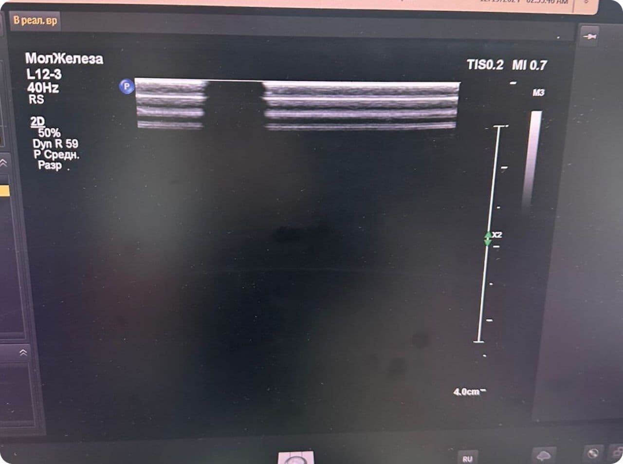 Philips Epiq 5 Ultrasound System Repair Service image 1