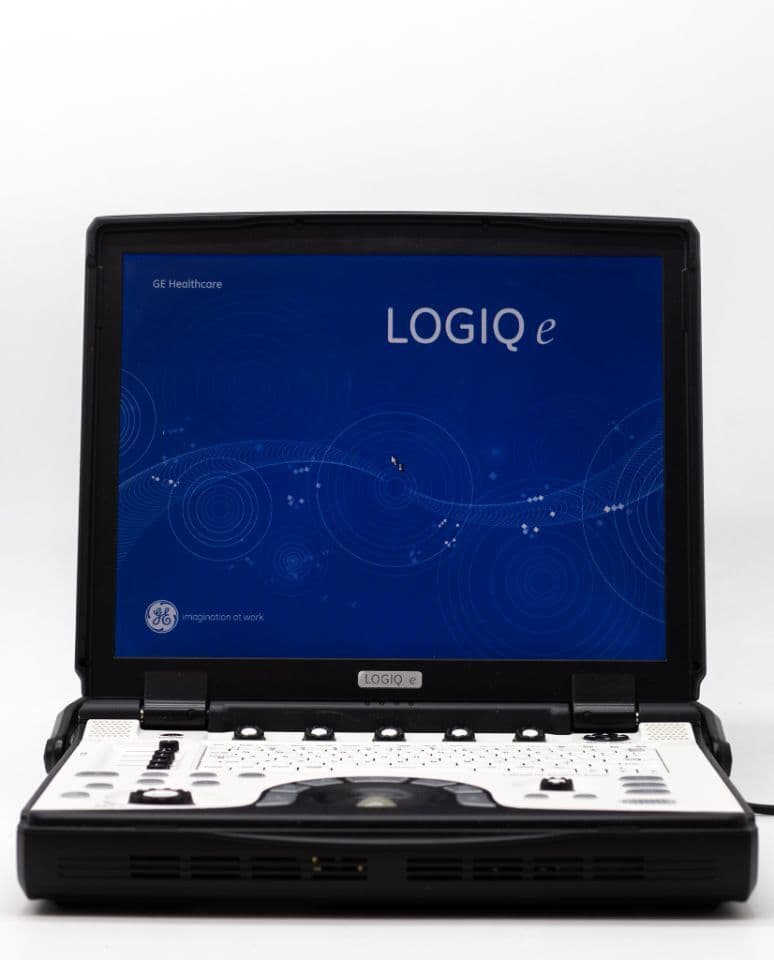 GE Logiq E Portable Shared Service Ultrasound System thumbnail 2