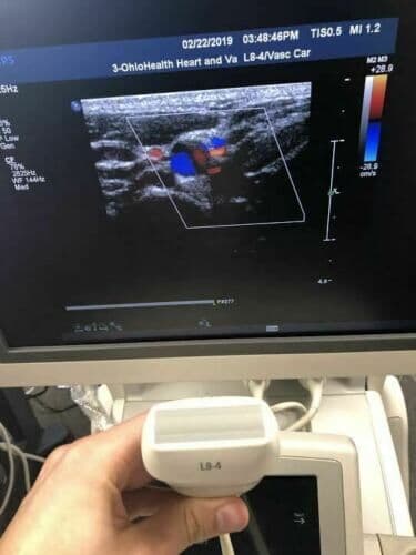 Philips L8-4 Linear Array Ultrasound Transducer Probe thumbnail 7