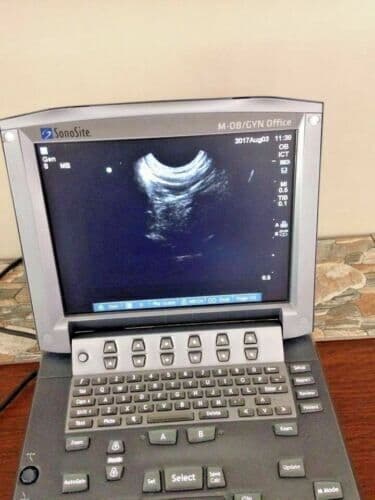Sonosite ICT/8-5 Intracavitary Ultrasound Transducer Probe thumbnail 4
