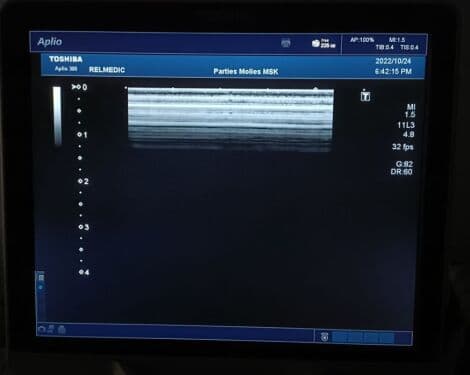 Toshiba PLT-705BT Linear Ultrasound Transducer thumbnail 5
