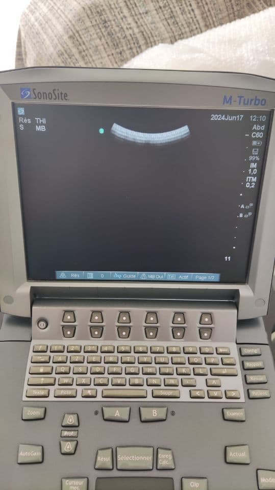 Sonosite C60x Convex Ultrasound Transducer thumbnail 6