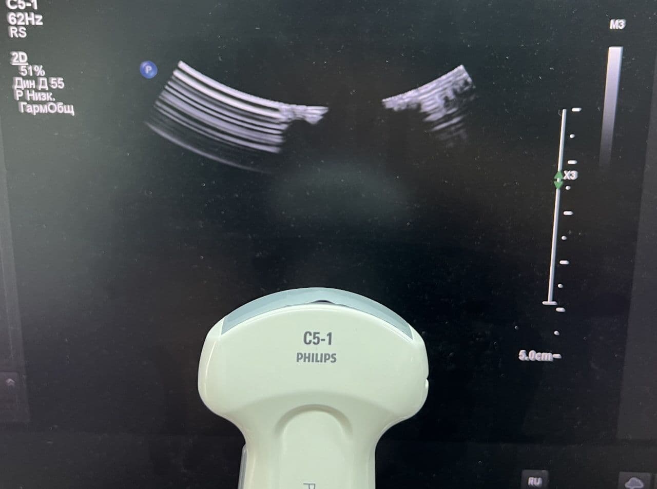 Philips C5-1 Convex Ultrasound Transducer image 1