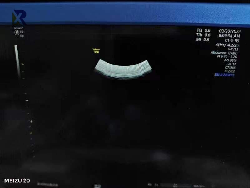 GE C1-5-RS Convex Ultrasound Transducer thumbnail 4