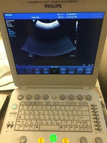 Philips C5-1 Curved Array Ultrasound Transducer thumbnail 6