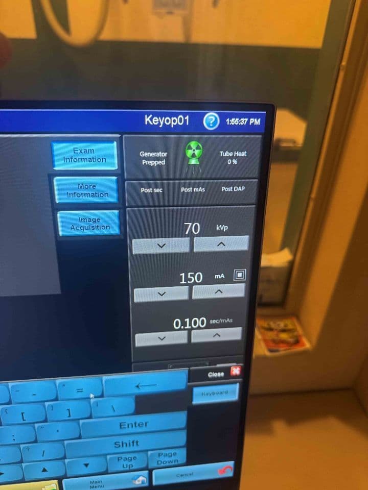 Carestream Revolution DR Digital Radiography Room thumbnail 5