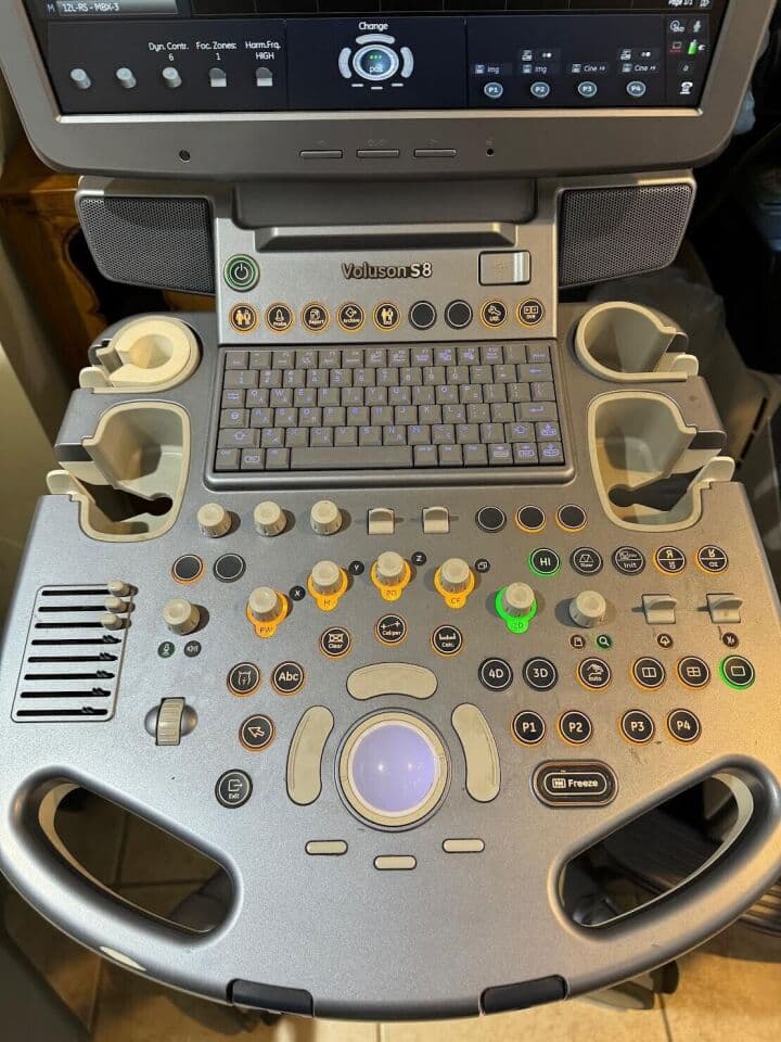 GE Voluson S8 3D/4D Ultrasound System thumbnail 5