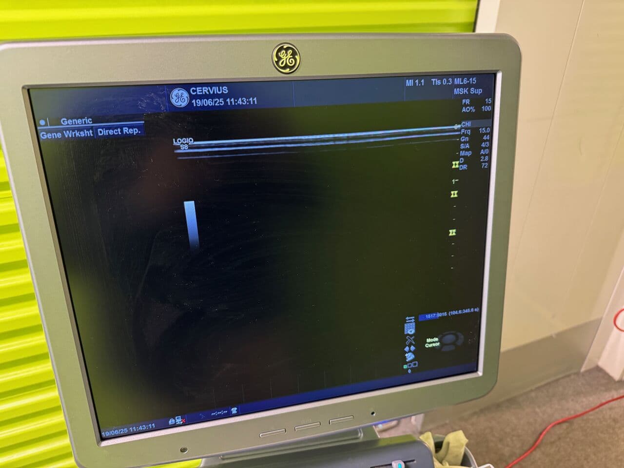 GE ML6-15-D Linear Array Ultrasound Transducer thumbnail 2