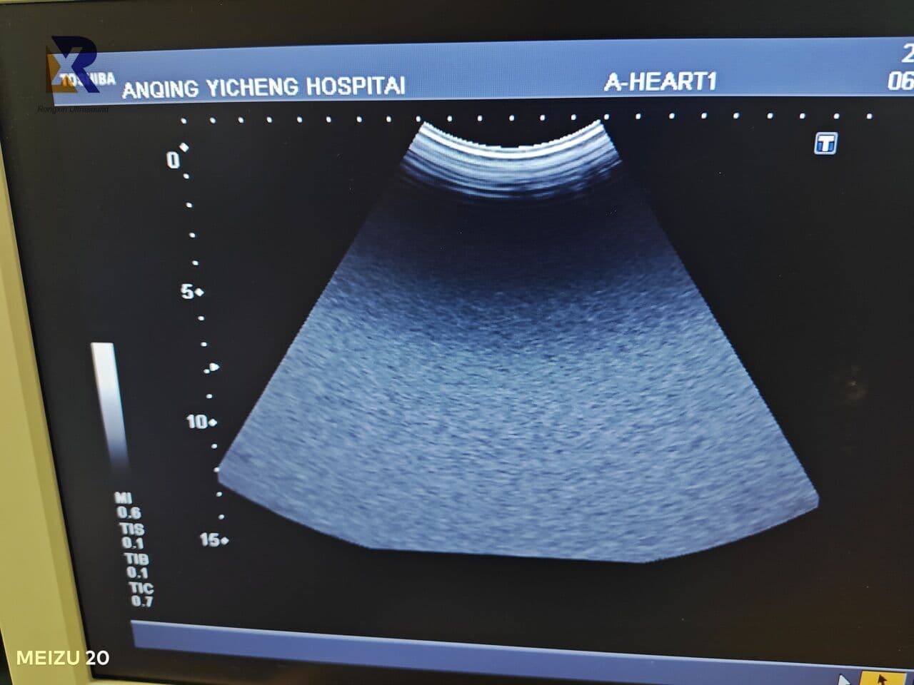 Toshiba PVM-375AT Curved Array Ultrasound Transducer thumbnail 4
