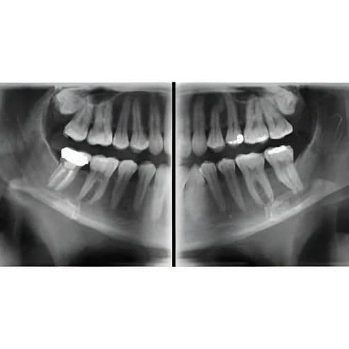 Vatech PaX-i Pan/Ceph Dental X-Ray System thumbnail 3