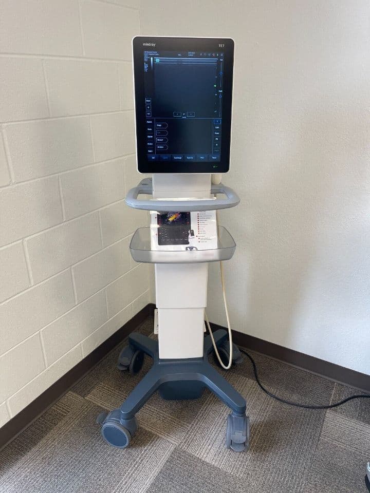 Mindray TE7 Portable Ultrasound System for Vascular and MSK Applications thumbnail 2