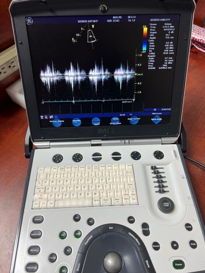 GE Vivid Q Portable Echocardiography Ultrasound System thumbnail 5