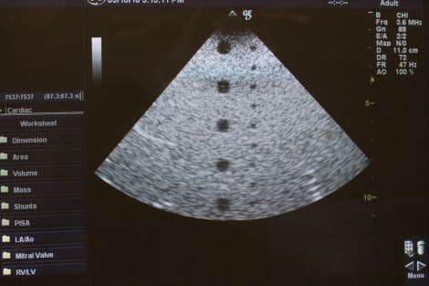 GE M3S Sector Matrix Array Ultrasound Transducer thumbnail 5