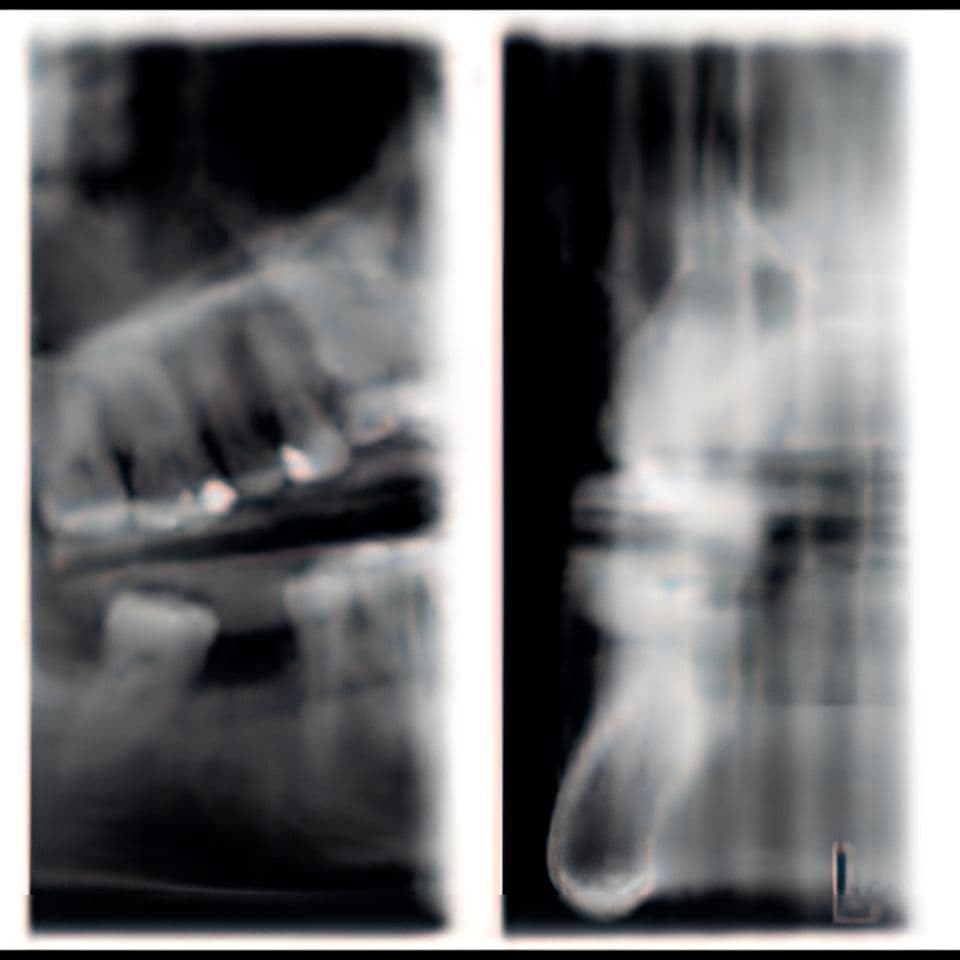 Planmeca ProMax Pan Dental X-Ray System thumbnail 13